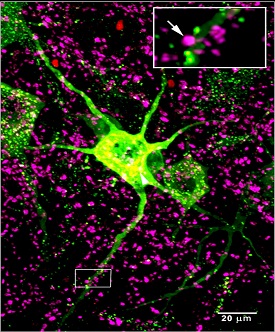 confocal microscope image of a motor neuron