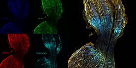 Fluorescently labeled nerve visualized using confocal microscope