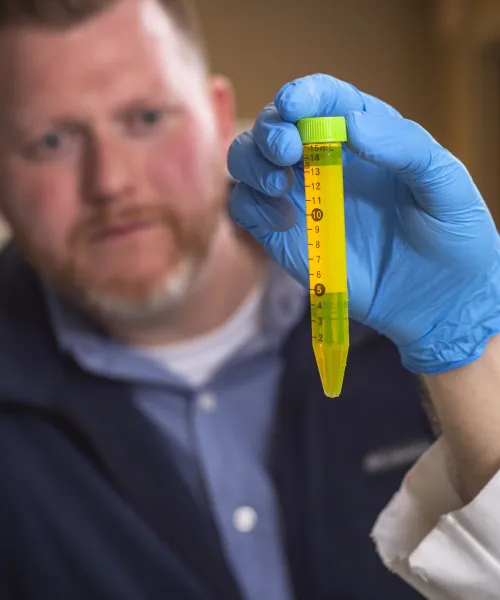 An individual  with short cropped, brown hair and a beard, in a collared purple shirt with a black vest over top is in the background. In the foreground is a person's hand with a blue glove holding a neon yellow vial with a green top and numbered markers up the side. 