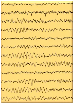 EEG picture